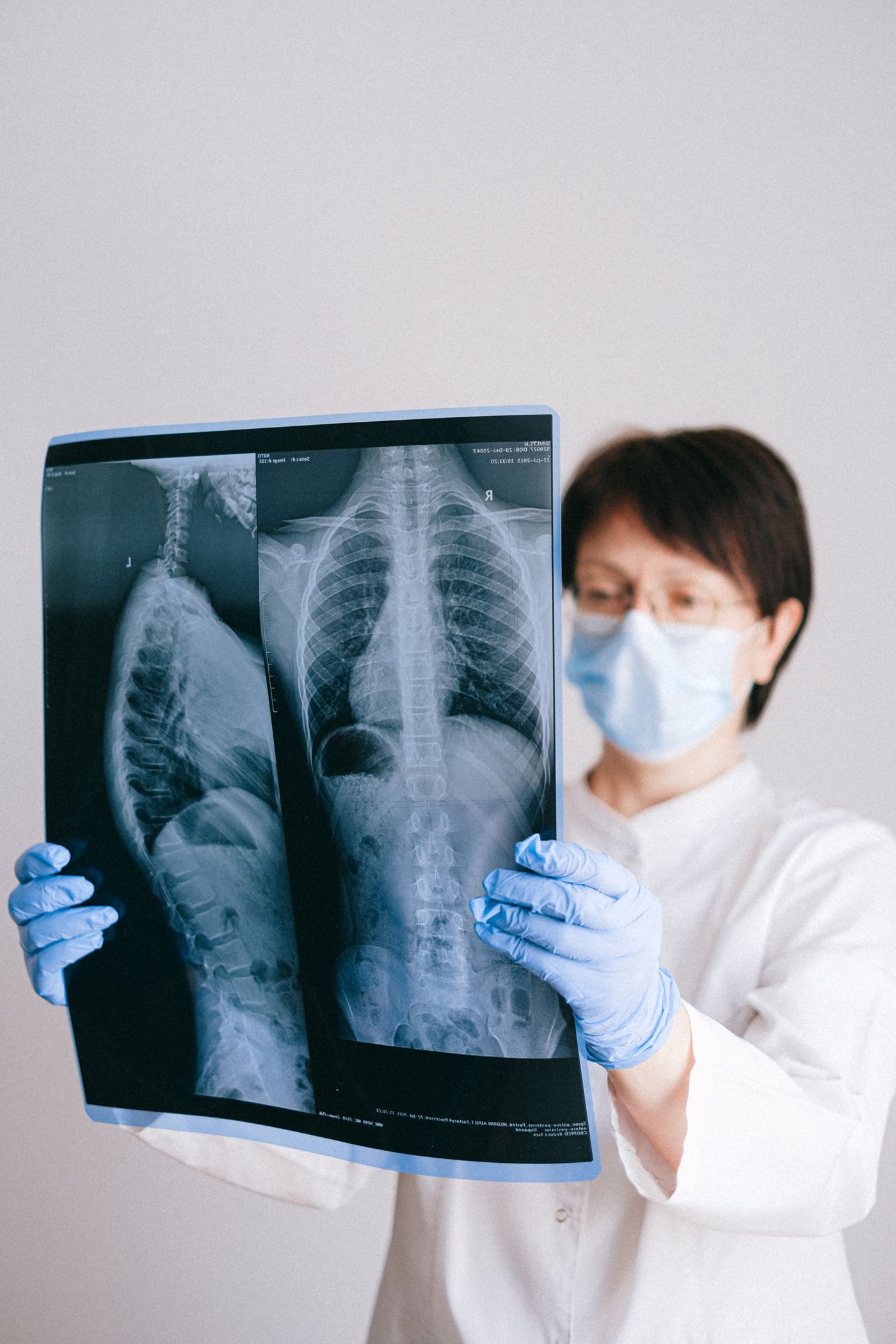 Médica analisando o resultado de um exame de raio X